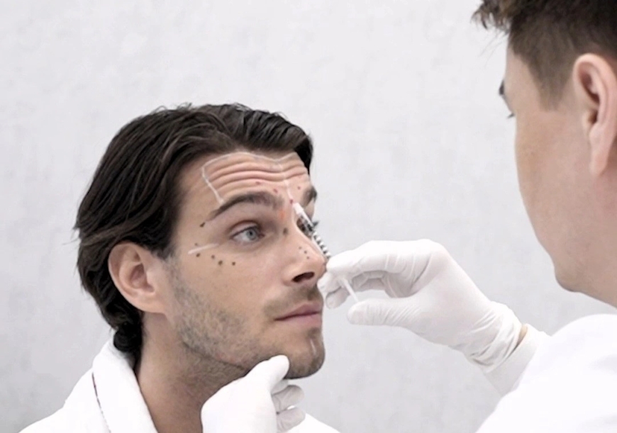 Botox for Men: Why the Best Plastic Surgeons in Dubai Are Seeing More Male Clients