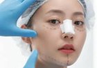 Trust Your Face to the Best: Chicago’s Leading Rhinoplasty and Nose Job Surgeons
