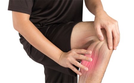 Expert Physiotherapy for Sciatica and Nerve Pain in Edinburgh