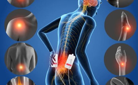 Top Treatments for Strong Pain Relief: Medications, Therapies & Tips