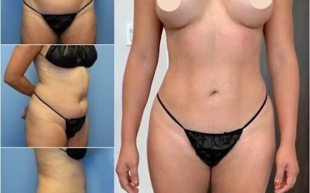 Discover the Best Body Contouring Surgeon in Dubai for Your Perfect Physique