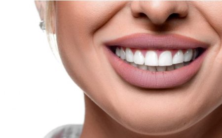 Hollywood Smile Makeover in Dubai: Get the Celebrity Smile You Deserve