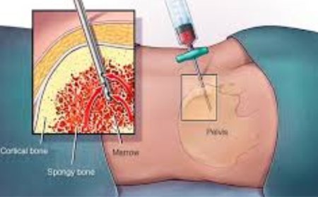 A Complete Guide to Leukemia Treatment Options and Outcomes