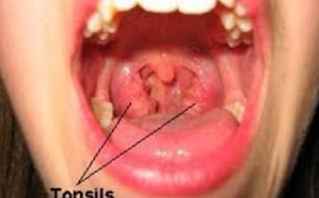 Still Dealing with Sore Throats or Snoring? Here's When You Might Need Your Tonsils Removed