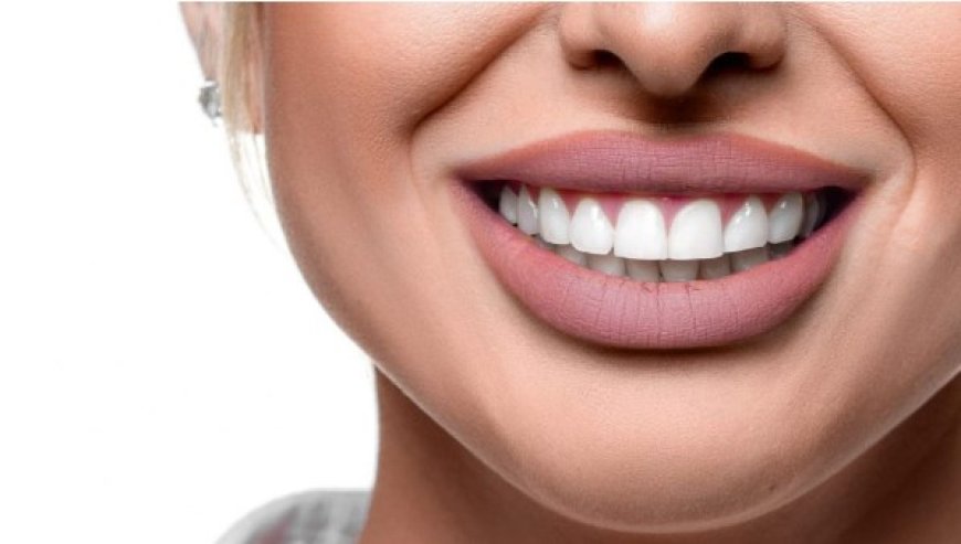 Hollywood Smile Makeover in Dubai: Get the Celebrity Smile You Deserve