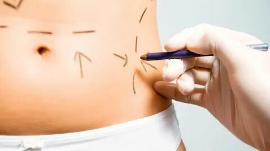 NYC J Plasma Lipo & Expert Liposuction