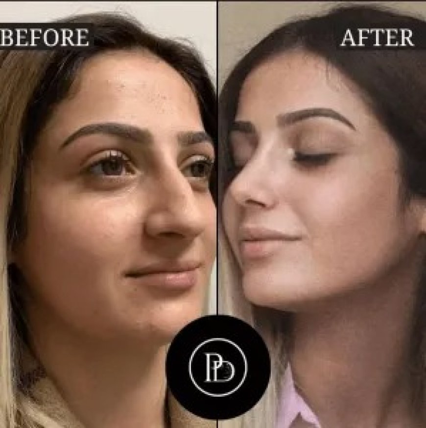 Best Plastic Surgeon in Dubai for Facial Contouring and Enhancements